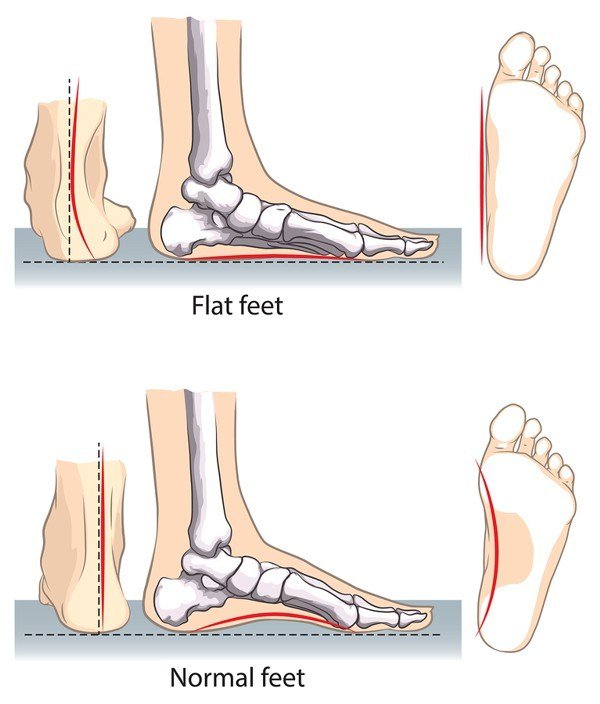 best nursing clogs for wide feet