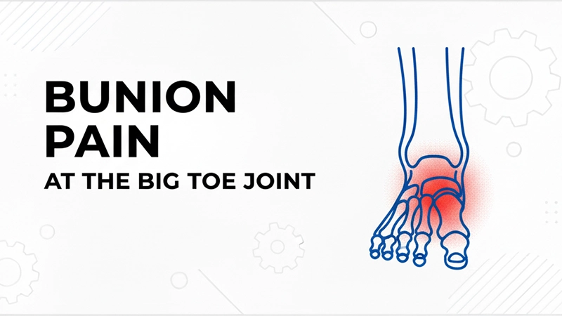 6 Most Common Foot Pain – Identify and Solutions 6 Bunion pain