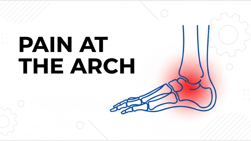 6 Most Common Foot Pain – Identify and Solutions 2 Pain at the Arch