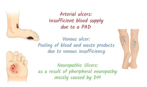 Blood circulation