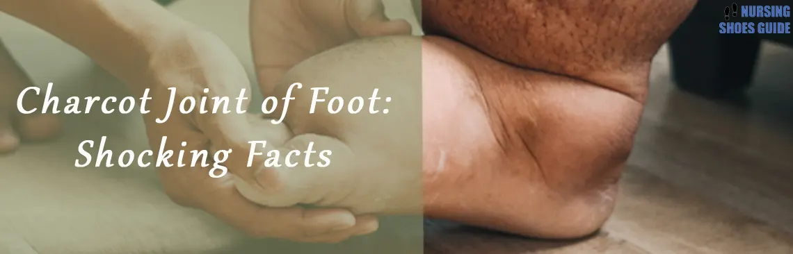 Charcot Joint of Foot: The Signs and Symptoms