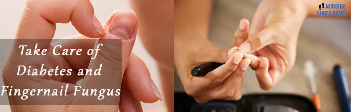 Take Care of Diabetes and Fingernail Fungus: Essential Steps!